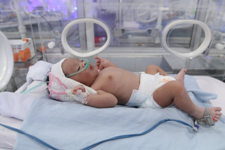 Bé sơ sinh đã ổn định sức khỏe, đang được chăm sóc tại Bệnh viện Phụ sản Hải Phòng. Ảnh: BVCC.