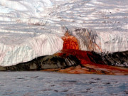 Tin tức - Sự thật về nơi sở hữu "thác máu", muốn tới phải nhổ răng khôn và cắt ruột thừa