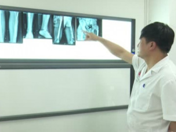 Tăng chiều cao bằng thủ thuật kéo dài chân có nguy hiểm không?