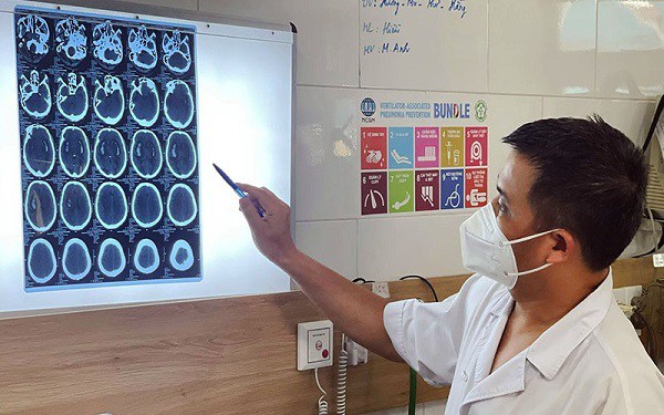 Bác sĩ Nguyên cho biết, có rất nhiều trường hợp ngộ độc rượu bị tổn thương não nghiêm trọng. 