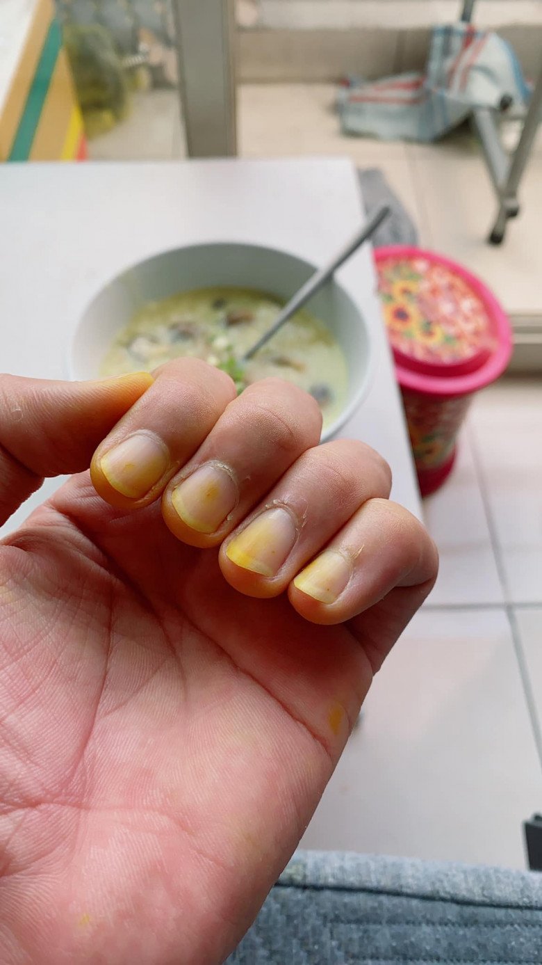Trong quá trình nấu ăn cho vợ, Khánh không hề ngại bàn tay bị dây bẩn vàng khè vì giã nghệ.