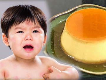 Cho con ăn loại bánh nhiều trẻ thích, 2 giờ sau bé tím tái, BS cảnh báo một điều bố mẹ nào cũng cần biết