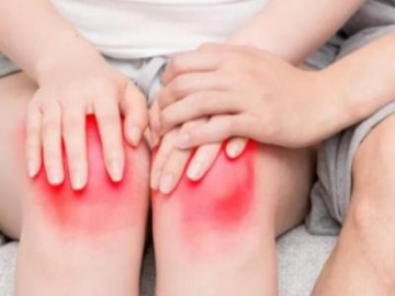 3 căn bệnh phải sống chung suốt đời, đừng để mắc phải