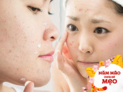 Đừng chăm da kiểu này những ngày cận Tết, có khi toang cả nhan sắc ngày mùng 1