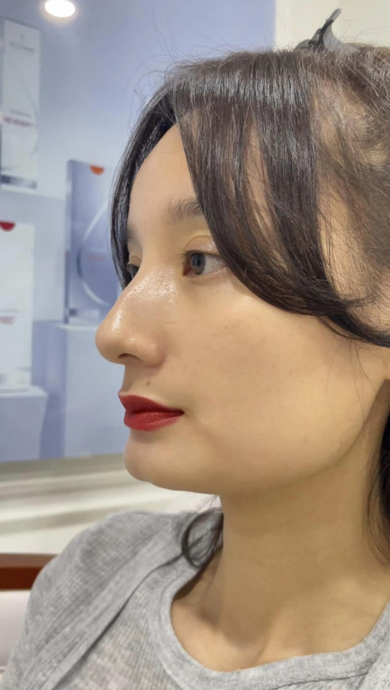 Không nhận ra siêu mẫu amp;#34;cò hươngamp;#34; Lê Thúy sau 8 năm lấy chồng đại gia, được Hồ Ngọc Hà chỉ đi thẩm mỹ - 4