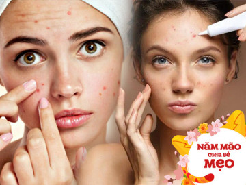 Đánh bay mụn sưng đỏ với nguyên liệu nhà nào cũng có, chị em yên tâm chăm da ngày Tết