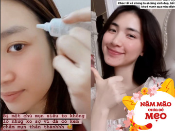 Về quê ăn Tết chớ quên đem kem chấm mụn, đến Hòa Minzy hay Đỗ Mỹ Linh cũng xài loại rẻ bèo