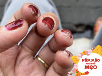 Làm bộ nails mấy trăm nghìn mà không biết những lưu ý này để giữ coi như mất Tết