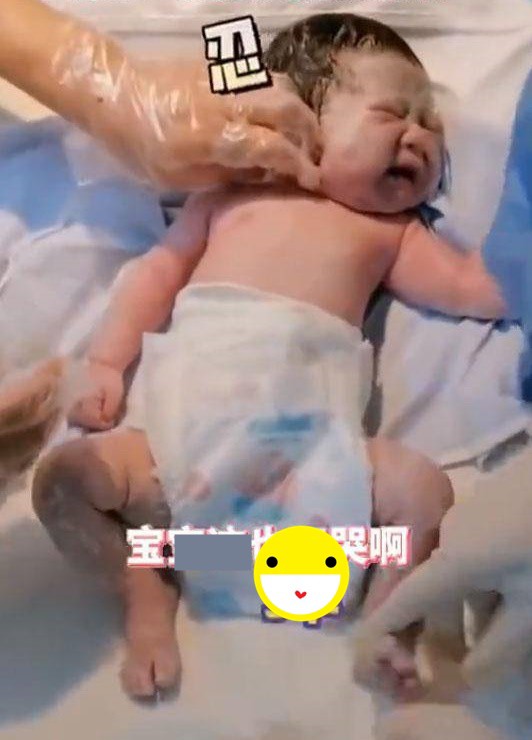 Bé sơ sinh chào đời đang ngủ ngon lành bị nữ y tá búng mạnh vào chân, mẹ nhìn thấy cảm ơn rối rít - 2