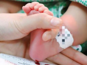 Sức khỏe - Mẹ trên 35 tuổi, bố trên 45 tuổi có nguy cơ sinh con bị khuyết tật