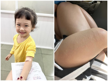 Sao Việt 24h: Con gái Ca Sỹ Pha Lê nổi mẩn đỏ rực, đi kiểm tra sức khỏe phân phát hiện nay dịch nghe thương hiệu rùng bản thân, tỷ phú Đức An lần thứ nhất biết