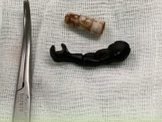 Sức khỏe - Đi làm xa về ăn Tết, mẹ thấy vùng kín con gái bất thường, đến viện bàng hoàng phát hiện thứ bên trong