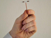 Bà bầu - Vòng tránh thai đi lạc chỗ - Cần chú ý những bất thường để phát hiện sớm