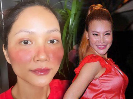 Phụ nữ Việt chớ dùng "kem trộn" vì cái mác rẻ đẹp như mỹ nhân Vbiz, kẻo tiền mất tật mang