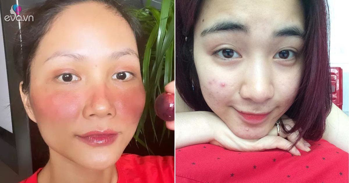 Phụ nữ Việt chớ dùng "kem trộn" vì cái mác rẻ đẹp như mỹ nhân Vbiz, kẻo tiền mất tật mang