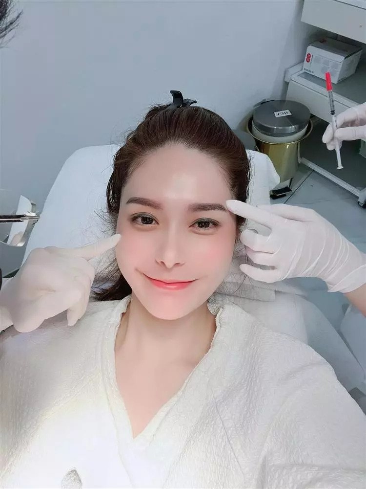 Bà mẹ 3 con cũng luôn công khai mình đã nhờ công nghệ thẩm mỹ đó là phương pháp tiêm filler để duy trì nét trẻ đẹp.