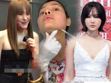 Tá hỏa nghe chuyên gia "bóc trần" sự thật về tiêm filler, tưởng giúp da căng bóng hóa ra dễ làm da thêm nhăn nheo