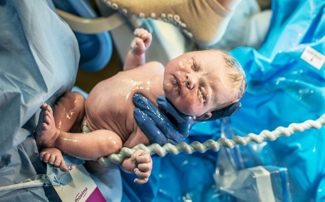 Em bé nằm ngoan ngoãn trong vòng tay của các y bác sĩ vừa giúp em chào đời an toàn.