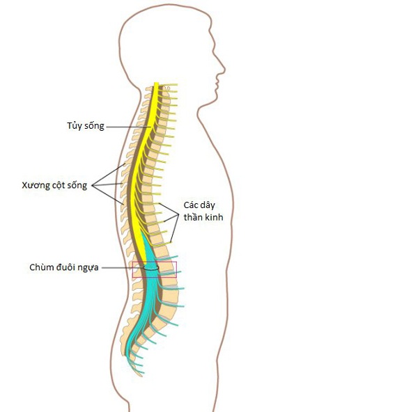 Những người từng bị thoát vị đĩa đệm có nguy cơ mắc hội chứng chùm đuôi ngựa. (Ảnh minh họa)