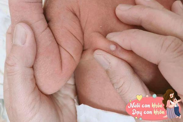 Cạo tóc, bóp đầu ngực... cho trẻ sơ sinh tưởng tốt, nhưng vô tình rước thêm bệnh cho con - 6