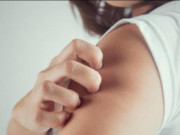 Clip Eva - Ung thư gan tìm đến, làn da sẽ phát ra 4 tín hiệu cầu cứu