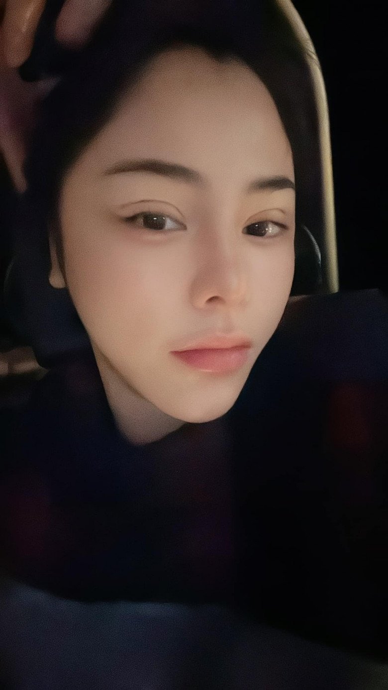 Chỉ vài tiếng sau khi nhấn mí, Bạch Lan Phương đã hí hửng khoe thành quả cho các fan. Cô nhận được mưa lời khen vì trông ngày càng trẻ đẹp.