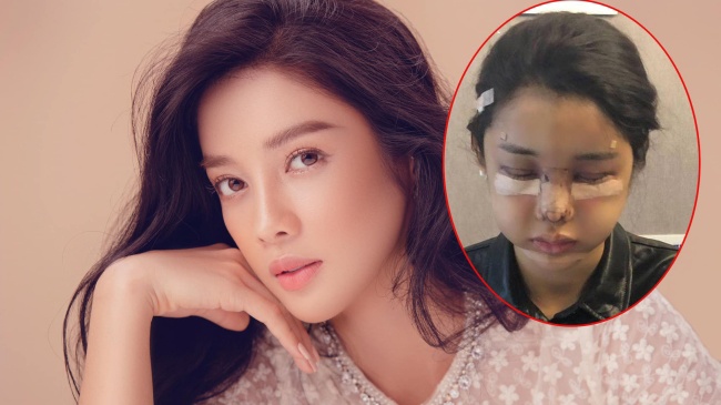 Mỹ nhân Tuyên Quang làm amp;#34;em gáiamp;#34; Mạnh Trường: Từng là thảm họa nàng Kiều, amp;#34;dao kéoamp;#34; 4 bộ phận trên mặt - 15