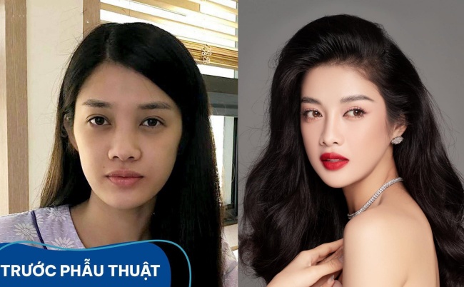 Mỹ nhân Tuyên Quang làm amp;#34;em gáiamp;#34; Mạnh Trường: Từng là thảm họa nàng Kiều, amp;#34;dao kéoamp;#34; 4 bộ phận trên mặt - 16