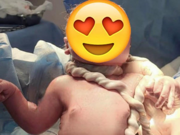 Mém xỉu với khoảnh khắc em bé vừa ra đời đã gây khó hiểu: Nhào lộn trong bụng mẹ kiểu gì thế này?