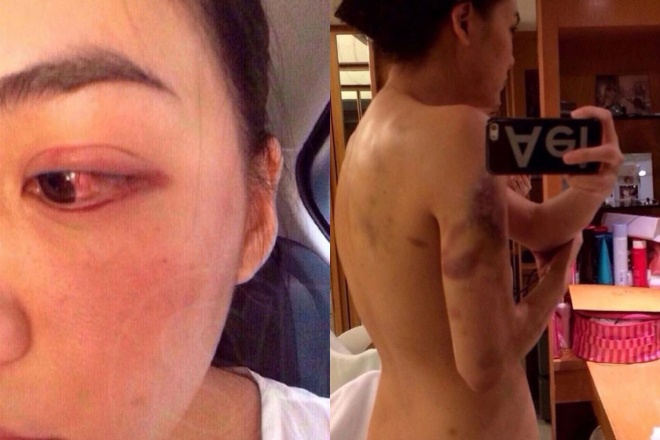 Janie bị chồng tỷ phú đánh đập.