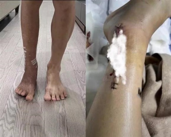 Hình ảnh chấn thương của anh được chia sẻ.