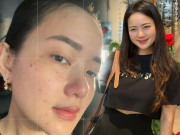 Làm đẹp - Phan Như Thảo bất ngờ xuất hiện với làn da mộc 100% chi chít mẩn đỏ, chuyện gì đã xảy ra?