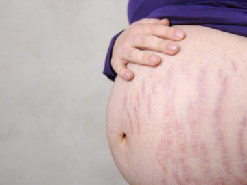 Những bệnh ở da khi mang thai có ảnh hưởng đến thai nhi?