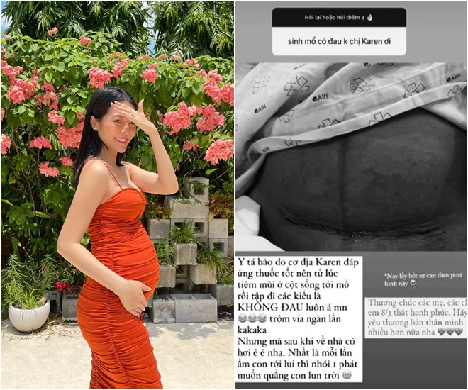 Karen cho biết cô không đau trong quá trình sinh vì đáp ứng thuốc tốt, khi về nhà mới cảm nhận nhói. Tuy nhiên vết mổ của nữ diễn viên làm nhiều người thấy thương phụ nữ.