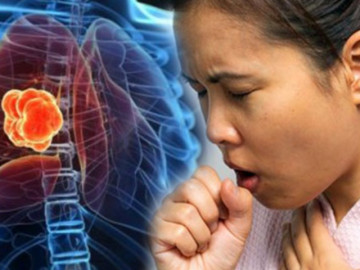 Bố hay hút thuốc, con gái một ngày ho nhiều rồi biết mắc ung thư, cảnh báo căn bệnh nguy hiểm tưởng...