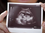 Bà bầu - Thai nhi 12 tuần: Đã có vóc dáng của trẻ sơ sinh và bắt đầu tăng tốc phát triển