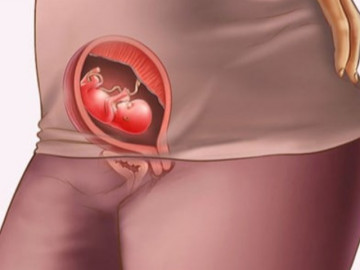 Thai nhi 11 tuần: Kích thước đầu của bé chiếm 1 nửa chiều dài cơ thể