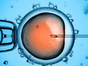 Chuẩn bị mang thai - Tất tần tật quy trình thụ tinh trong ống nghiệm vợ chồng chuẩn bị làm IVF cần biết