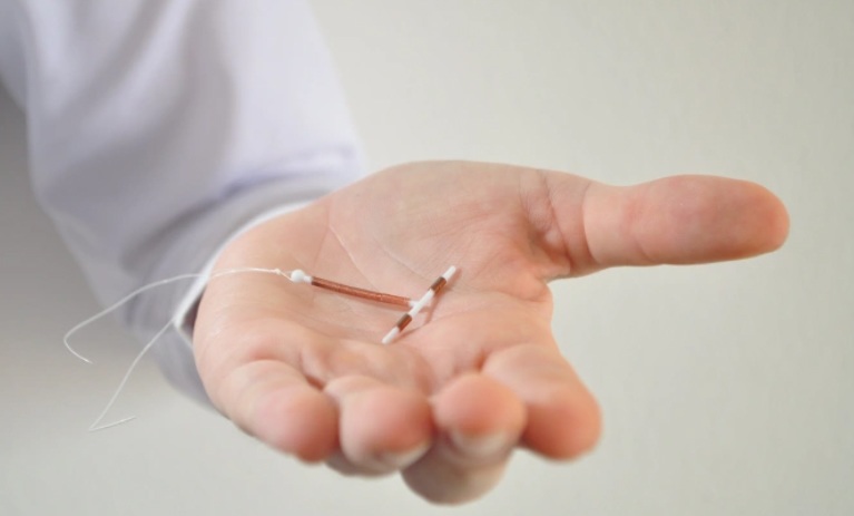 Không thể có bầu chỉ vì chiếc vòng tránh thai nằm trong cơ thể 29 năm mà không hề hay biết.