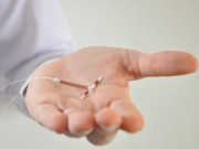 Bà bầu - 8 lần thụ tinh ống nghiệm thất bại chỉ vì bỏ quên vòng tránh thai trong cơ thể suốt 29 năm