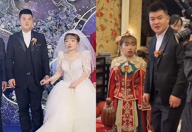 Chiều cao dừng ở 1m3, người phụ nữ cưới bạn thân hồi nhỏ, ngỡ ngàng với diện mạo chú rể - 1
