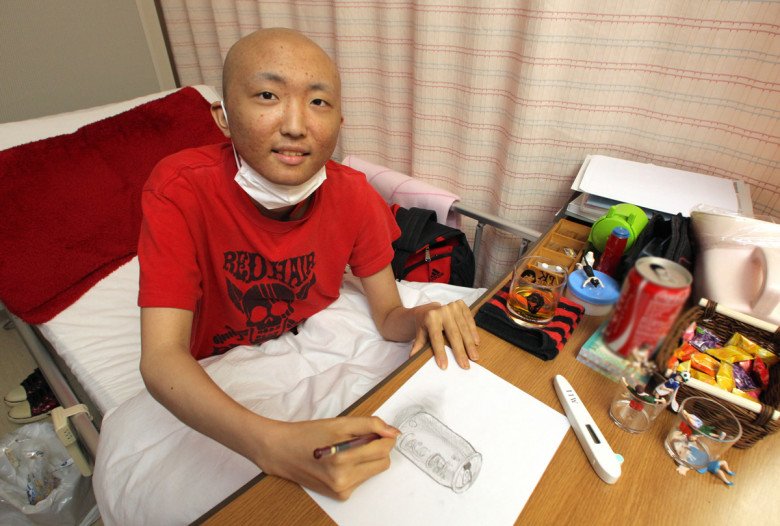 Ung thư dạ dày khá phổ biến ở Nhật - quốc gia có nhiều người sống thọ nhất nhì thế giới. (Ảnh minh họa)