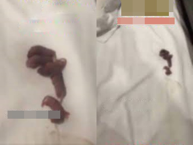 Vừa nằm lên giường khách sạn thì thấy âm thanh lạ, người đàn ông choáng nặng khi lật gối lên - 2