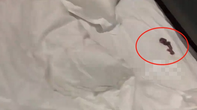 Vừa nằm lên giường khách sạn thì thấy âm thanh lạ, người đàn ông choáng nặng khi lật gối lên - 1