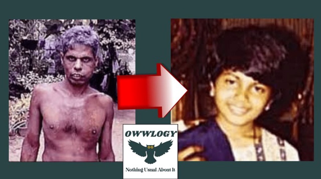 Bé gái 4 tuổi đột nhiên kể chuyện tiền kiếp, bố mẹ vạch áo phát hiện sự thật ngỡ ngàng - 1