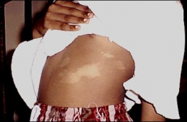 Bé gái 4 tuổi đột nhiên kể chuyện tiền kiếp, bố mẹ vạch áo phát hiện sự thật ngỡ ngàng - 3