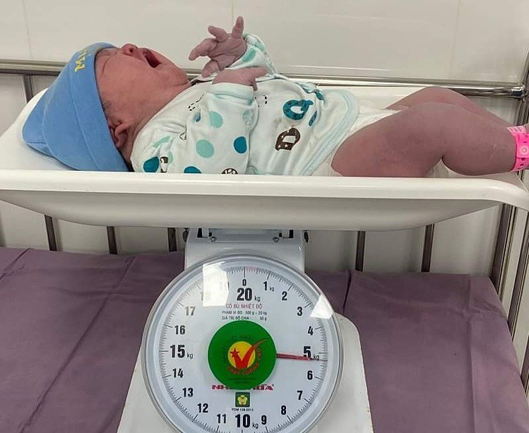 Bé gái chào đời nặng 5,3kg, cân nặng tương đương trẻ hai tháng tuổi, gây bất ngờ cho mẹ và y bác sĩ. 