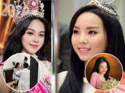 Làm đẹp - Là biểu tượng nhan sắc, loạt Hoa hậu "rủ nhau" sửa sang, người vô địch nhân trắc học vẫn chỉnh dáng