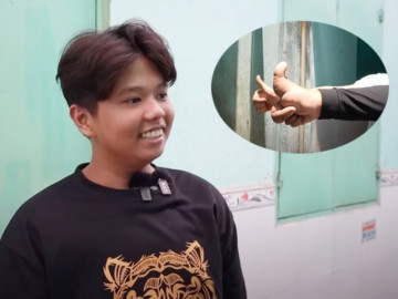 Chàng trai Sóc Trăng sở hữu ngón tay cái độc nhất vô nhị, ai gặp cũng nhìn chằm chằm và phản ứng bất ngờ