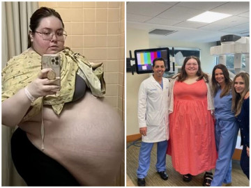 Người phụ nữ bụng to như mang thai 10 đứa trẻ và sự thật bất ngờ phía sau